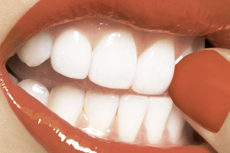 Пять привычек, которые разрушают наши зубы